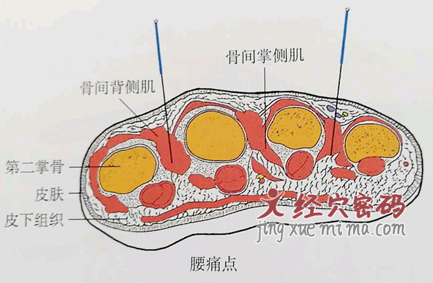 腰痛点的位置解剖图（图解）