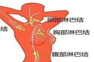 结节到底是什么？ 怎么消除 ？