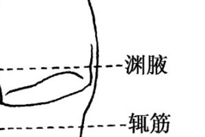 失眠通常有几种 ，这样拍拍，差不多就好了