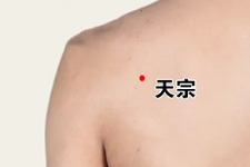 程凯养生说：口腔扁平苔藓为什么久治不愈？