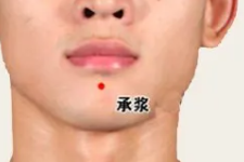 程凯养生说：下颌痤疮—女性生殖功能变化的标志