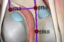 程凯养生说：治腰先治膝，治膝亦治腘