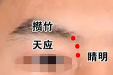 程凯养生说：快速“提高视力”的穴位是什么？