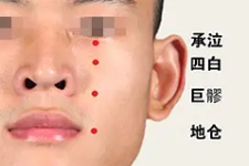 程凯养生说：送给老爸老妈的口周保健穴