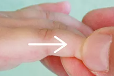 【妈妈的烦恼】便秘时要多给宝宝揉揉肚子