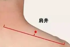 医保·医案分析：交感型颈椎病中医治疗方法