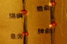 郁证重用奇经穴