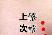 夏天到了，又痛经了，该如何防？