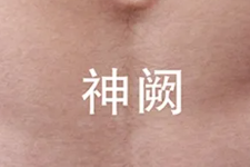 柳絮纷飞，我们该如何防过敏？