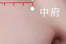 【每日穴习】内伤咳嗽，中府来治