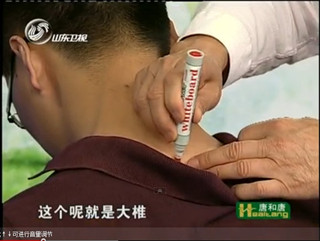 大椎穴的位置 大椎穴的位置