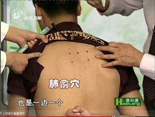 肺俞穴的位置 肺俞穴的位置