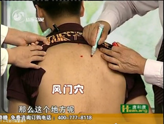 风门穴的位置 风门穴的位置