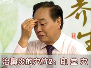 治疗鼻炎的穴位:印堂穴的位置图 治疗鼻炎的穴位:印堂穴的位置图