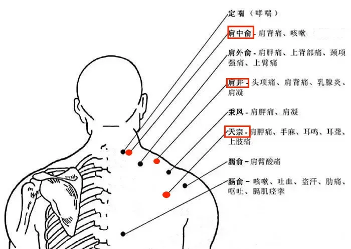 落枕了,颈部疼痛不敢动,按揉这里,有效改善落枕现象 落枕了,颈部疼痛不敢动,按揉这里,有效改善落枕现象