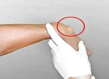 鼠标手、键盘手?每天这样按摩,通经活络,治疗腱鞘炎