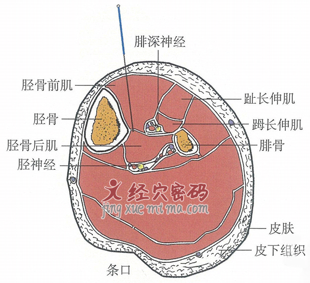 条口的位置解剖图（图解）