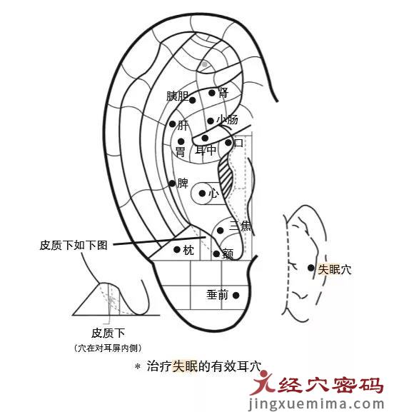 程氏针灸独门耳穴处方，帮助患者摆脱20年顽固失眠