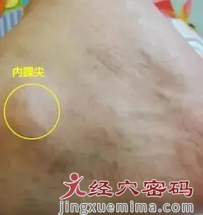 人体有两处腰痛奇穴：治腰痛有奇效