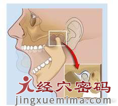 医案分享：因为一个喷嚏引起的疼痛