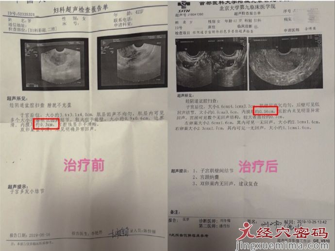 医保·医案分享：月经紊乱、崩漏、停经等月经病诊疗方案