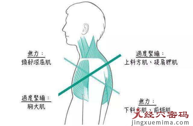 医师分享：什么是上交叉综合症？