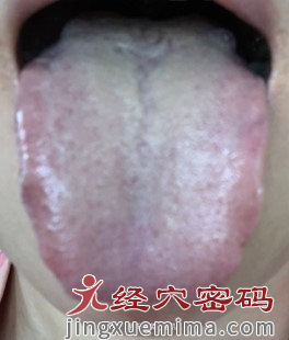 远程会诊医案分析：看到这样的舌像，小心身上长结节囊肿