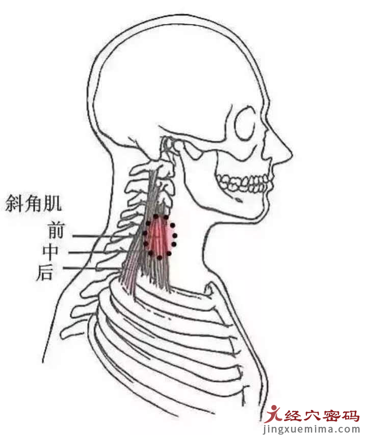 医案分析：中医针灸治疗右侧头部晕胀，颈肩背部僵硬