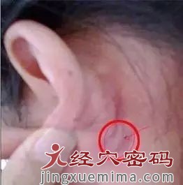 耳后一个窝,专门辅助降糖调血!每天按10秒钟,很不错! 耳后一个窝,专门辅助降糖调血!每天按10秒钟,很不错!